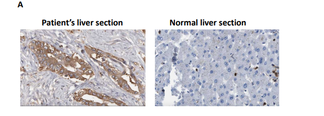 BB2804: Data Analysis, Interpretation and Presentation